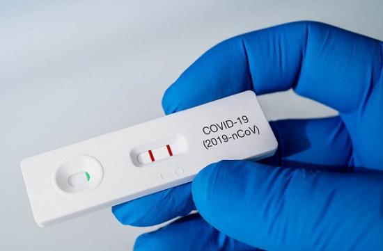 Photograph of Covid Reinfections: Are They Milder And Do They Strengthen Immunity?