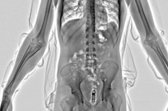 Photograph of New Airport-style Security In Prisons Sees Record Level Of Drug Busts